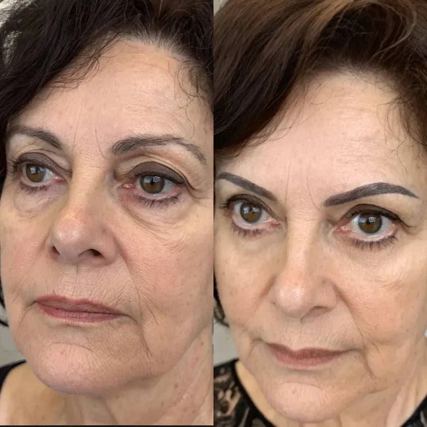 LumiEyes™ Advanced Red Light Eye Therapy